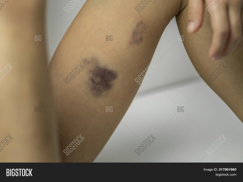 Cruel beating of naked women