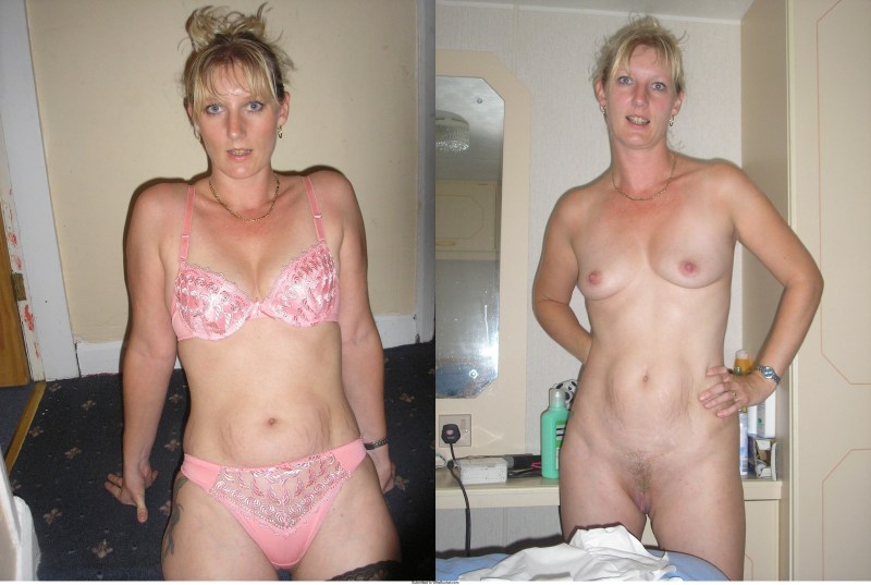 Hairy girls dressed striped