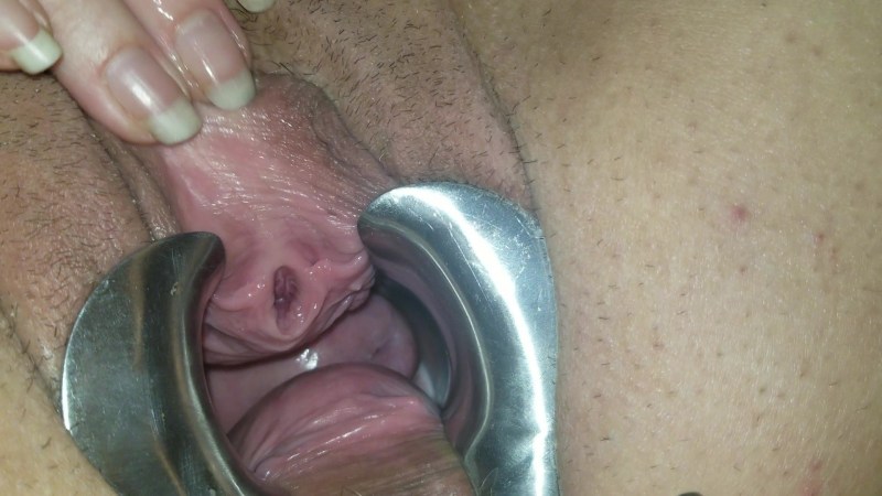 Urethral expanders in vagina