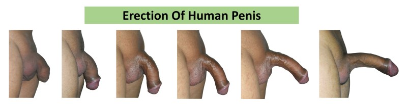 Forms of female genitals