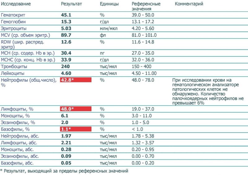 Fat women in 50 in pantyhose