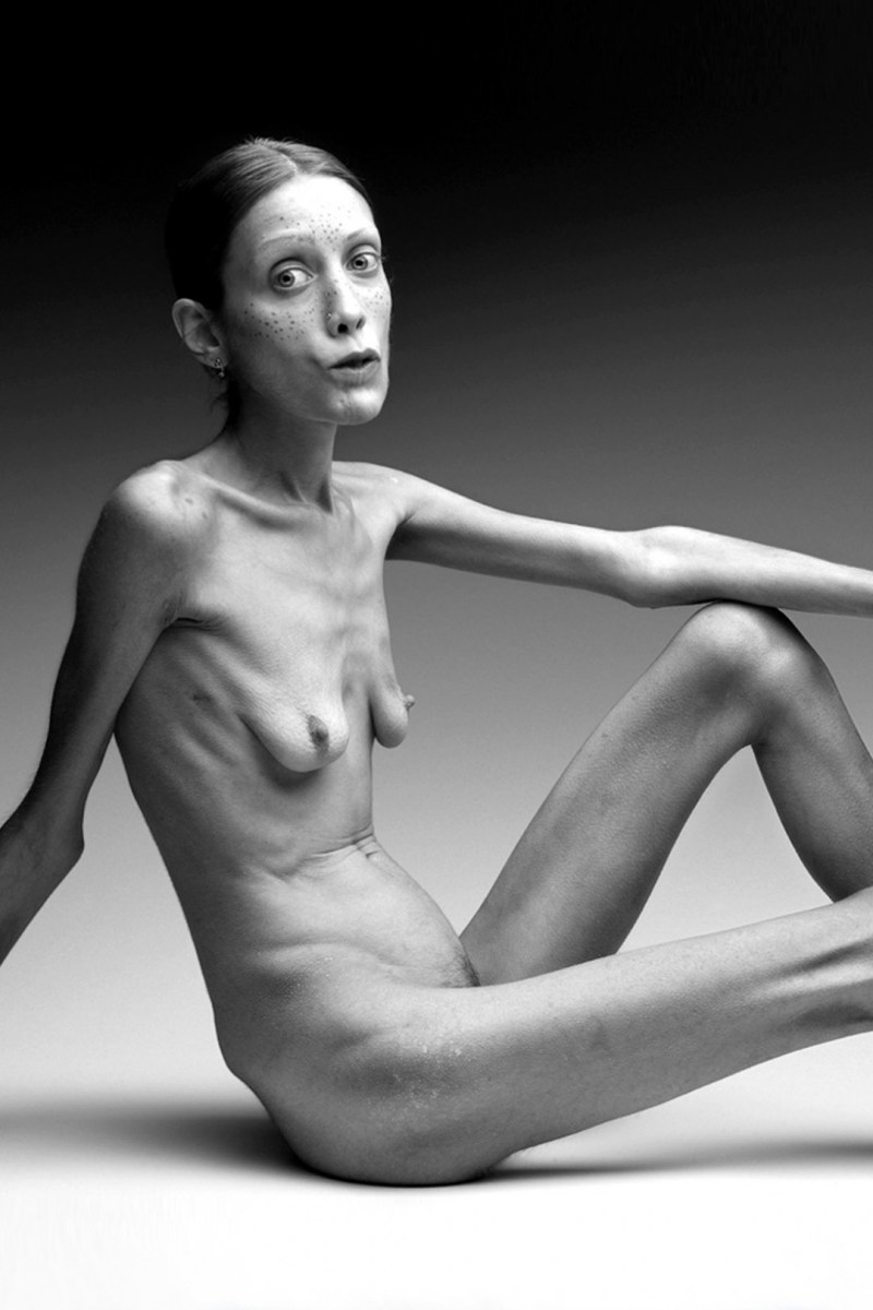 Naked anorexics photo