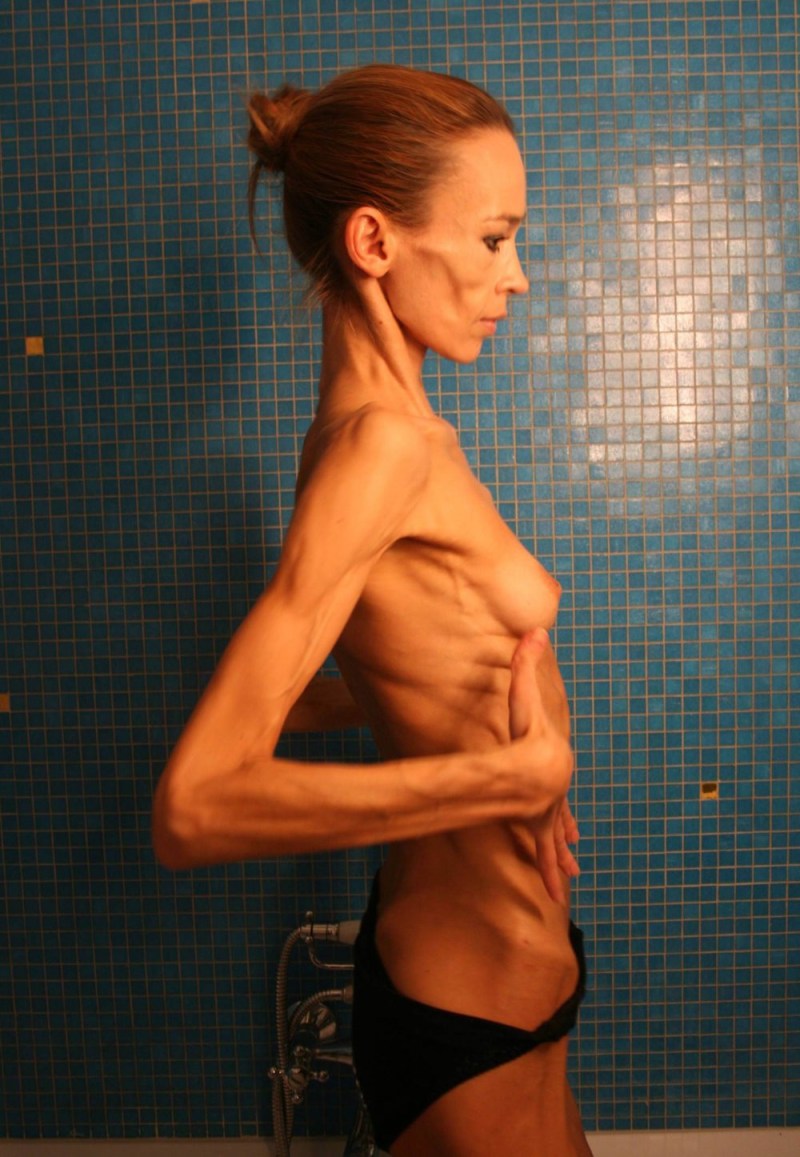 Naked anorexic women