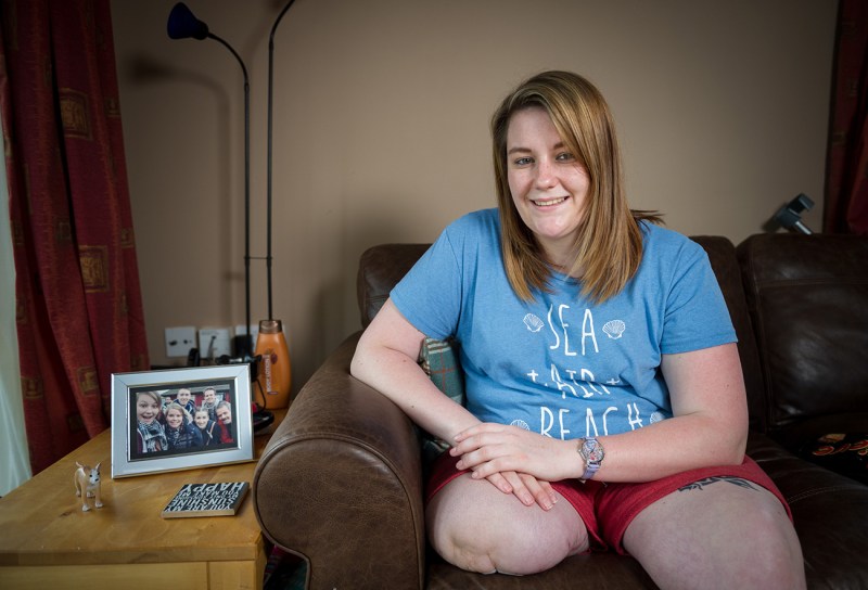 Naked women amputants