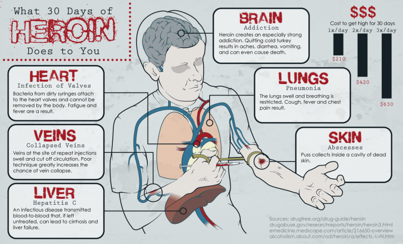 Shibari breast scheme
