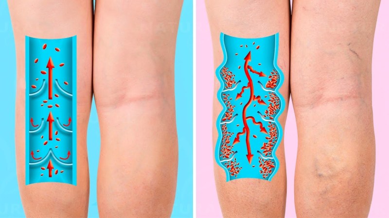 There is the screensaver