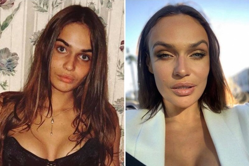 Vodonaeva to breast decrease