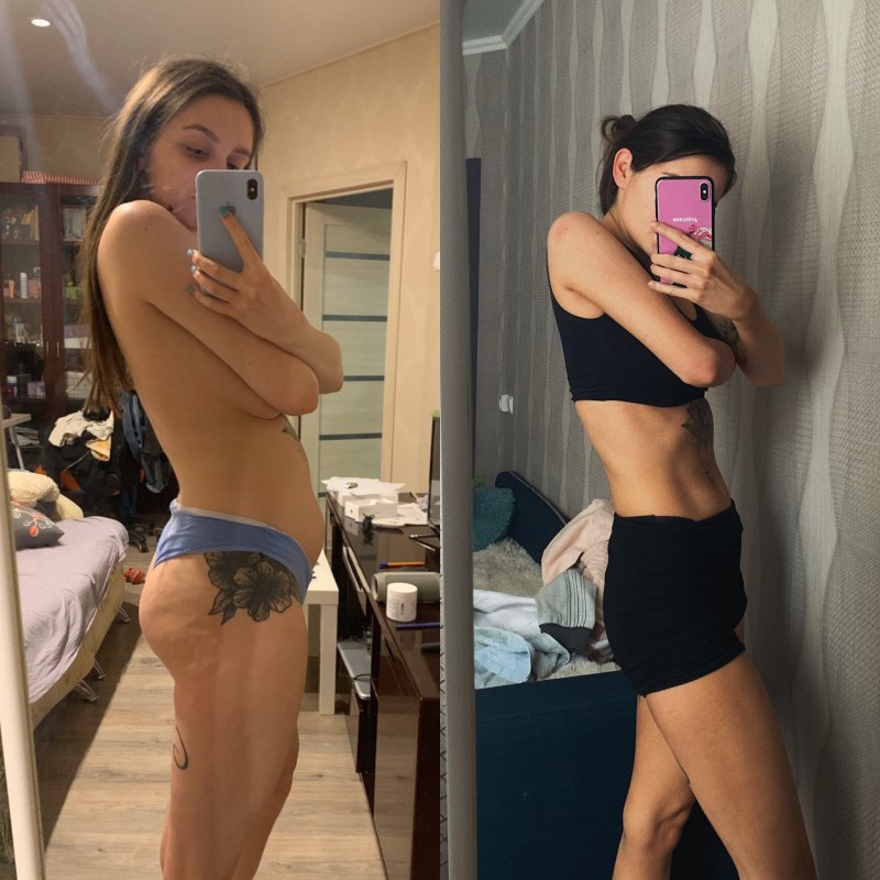 Lyasheva twich drain