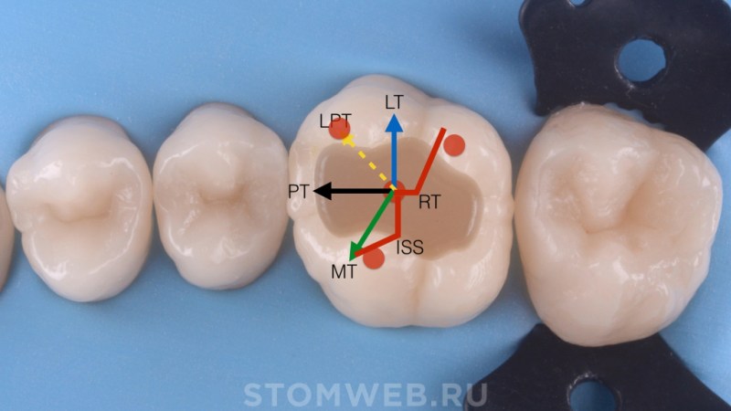 Giant girl swallows people