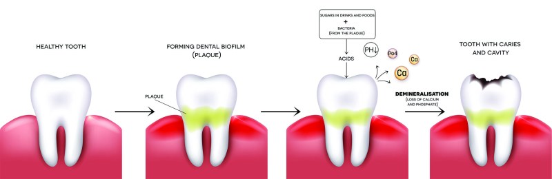 Elgidium pasta tooth protection against caries tube 75 ml