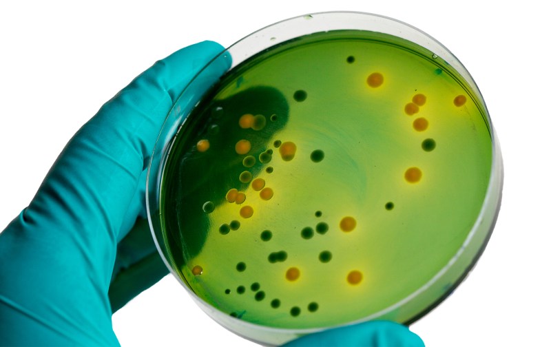 Pulpite periodontitis tooth classification