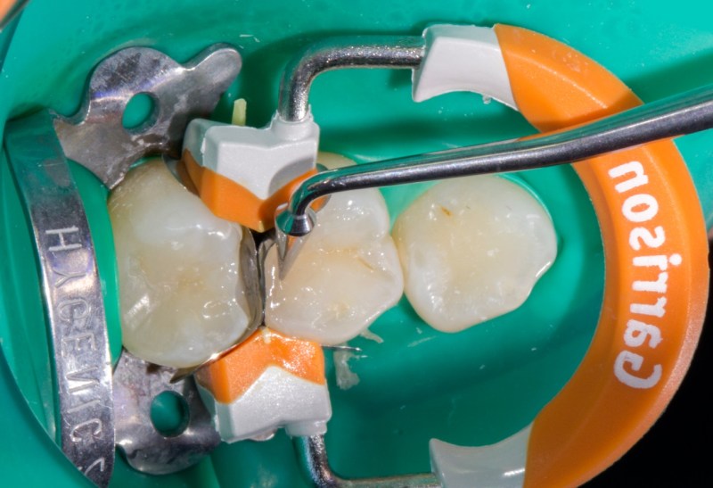 Insulin classification of drugs drug