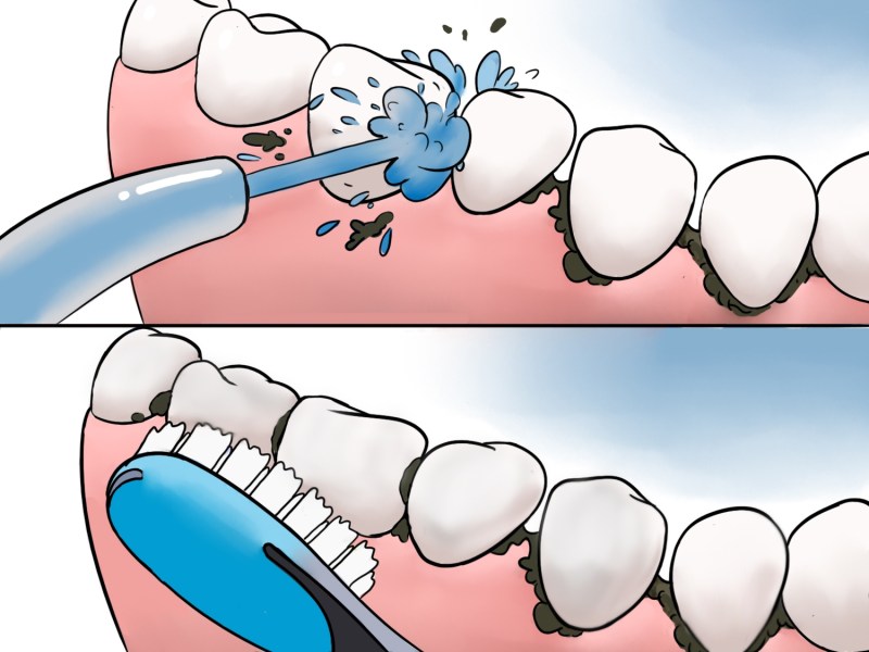 The first molar of the upper jaw of the hillock
