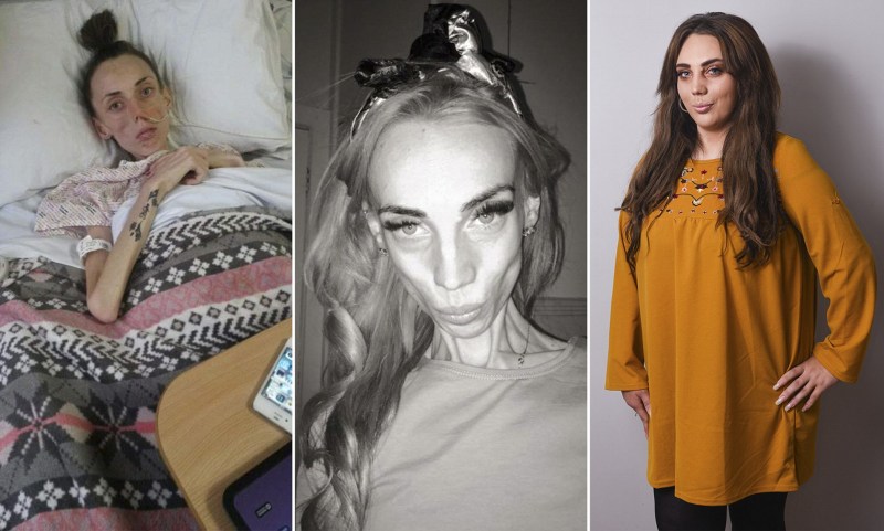 Dasha Parkhomenko anorexia