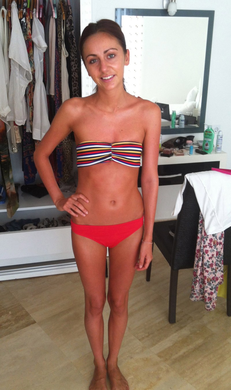 Holly Griffith anorexia