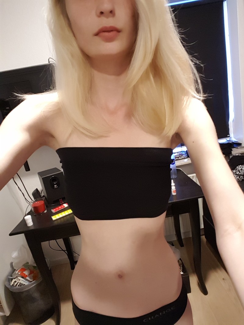 Julia Mikhalchik anorexia