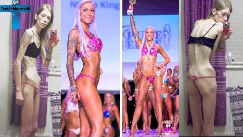 Victoria Prikhodko anorexia