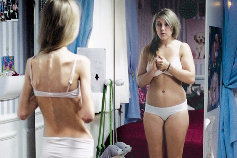 Olga Tereshchenko Anorexia