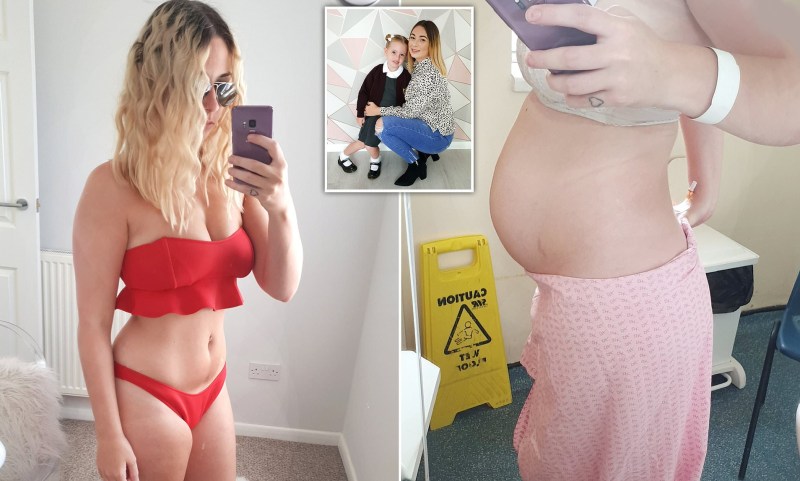 Beautiful girls with anorexia