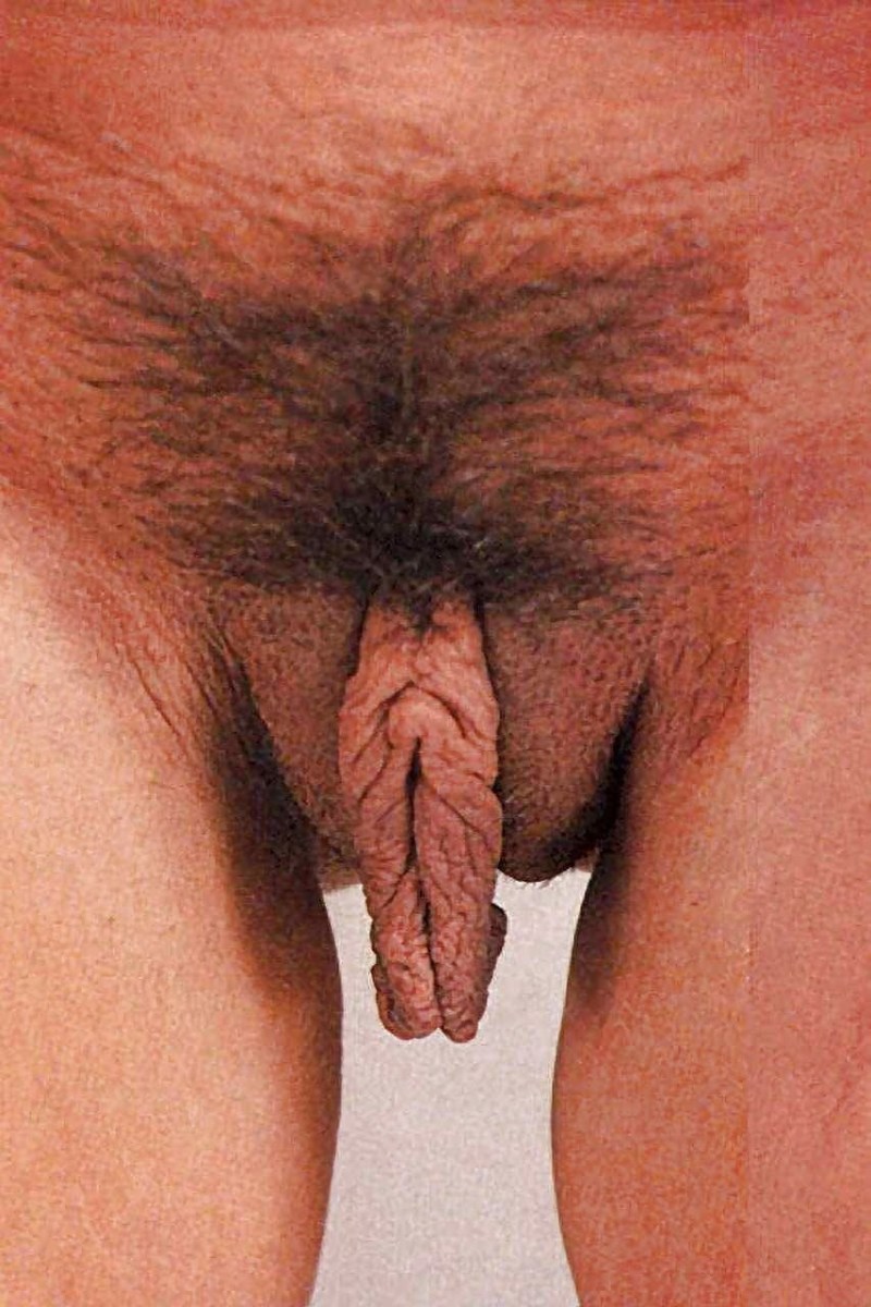 Beautiful convex pubis