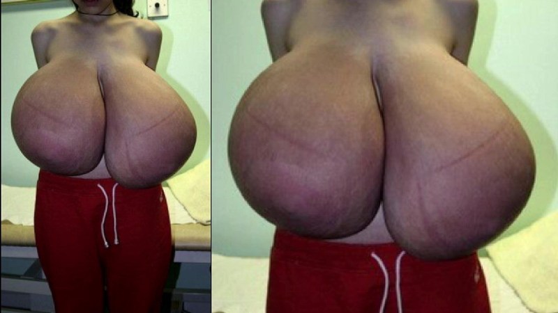 Macomastia big boobs