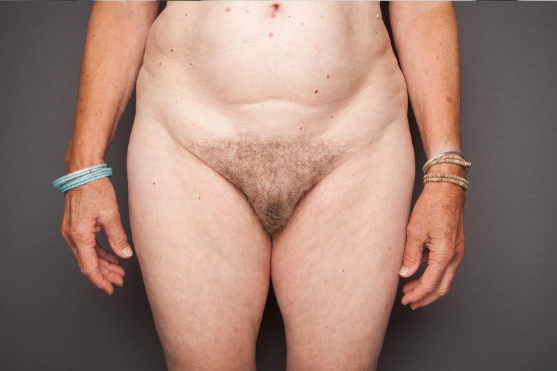 Naked thin elderly women