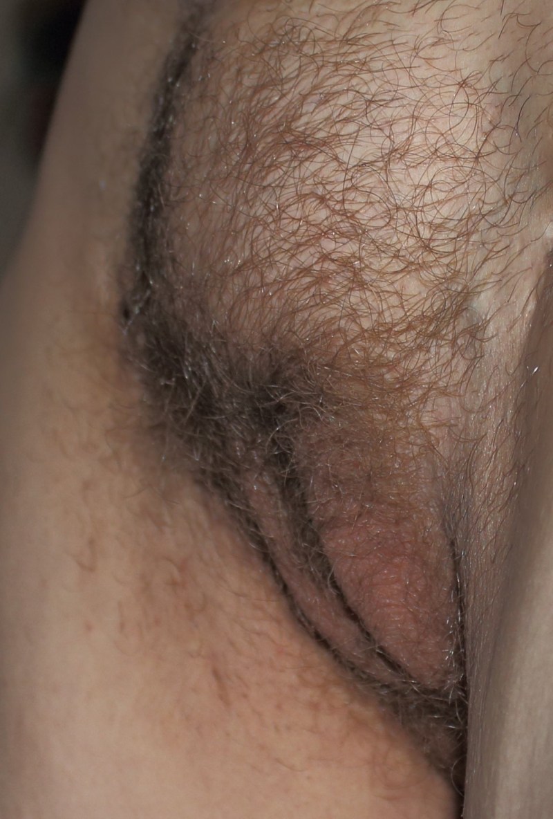 Female pubic hair