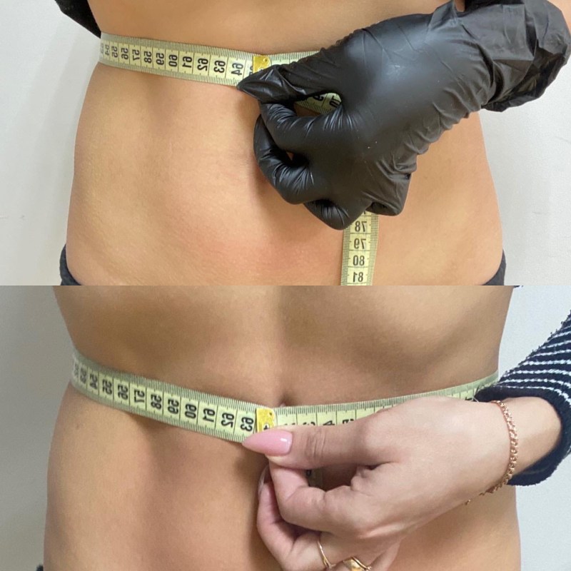 Yana Melikhova Yelets