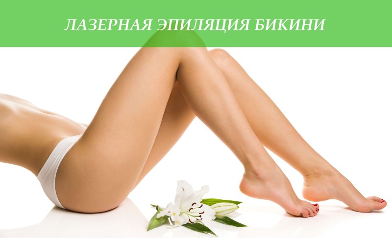 Promotion laser hair removal