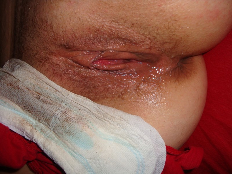 ZKé-Pulber Licking Discharge vagina photo large