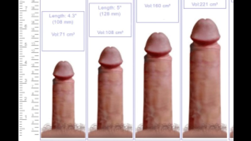 Various forms of penis