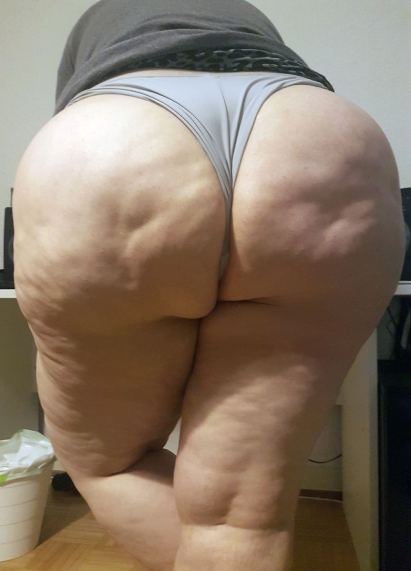Cellulite hips of women