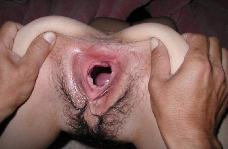 Huge vagins after fisting