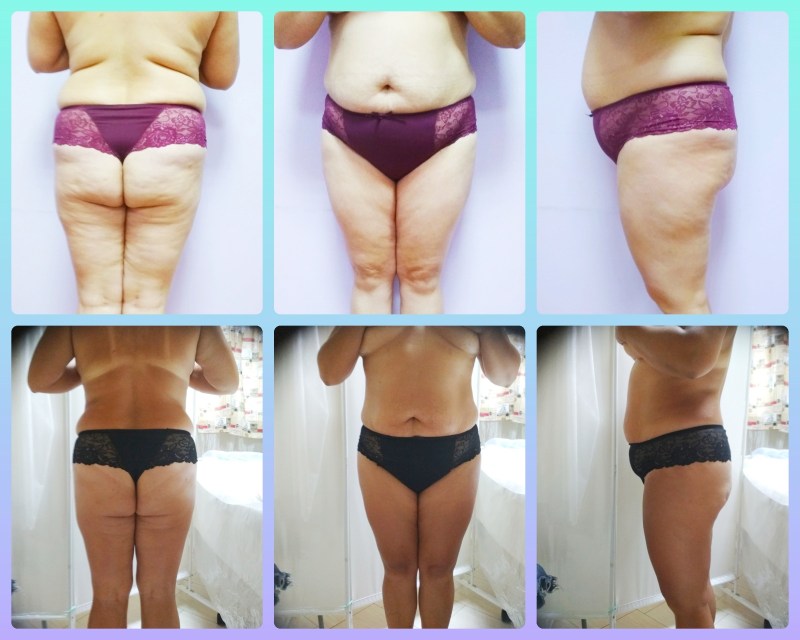 Ekaterina Kuznetsova in a swimsuit with friends