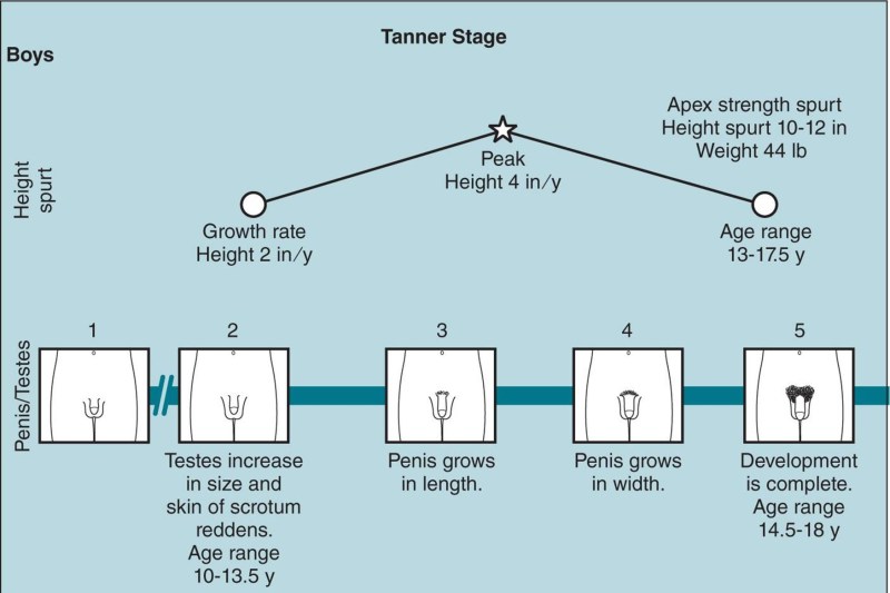 Opinated teacher Before after