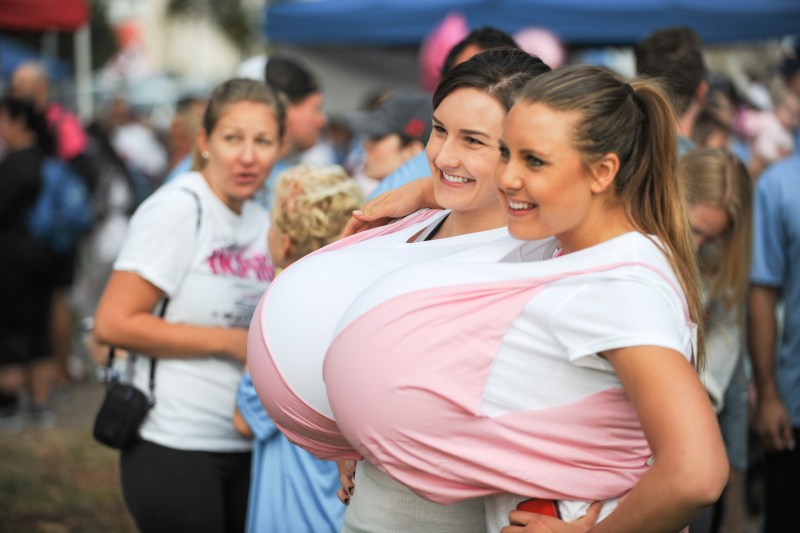 Ultrasound of the mammary glands