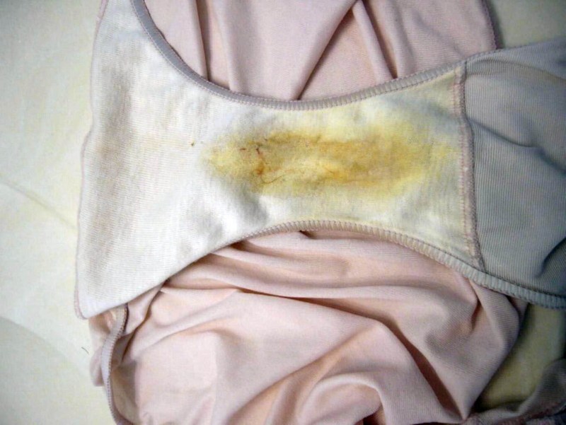 Adult women in dirty underpants