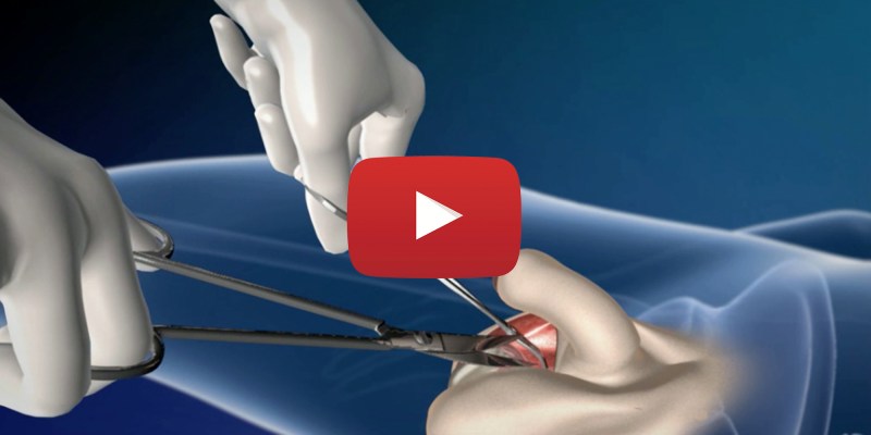 Masturbator Vagina Kokos Emily