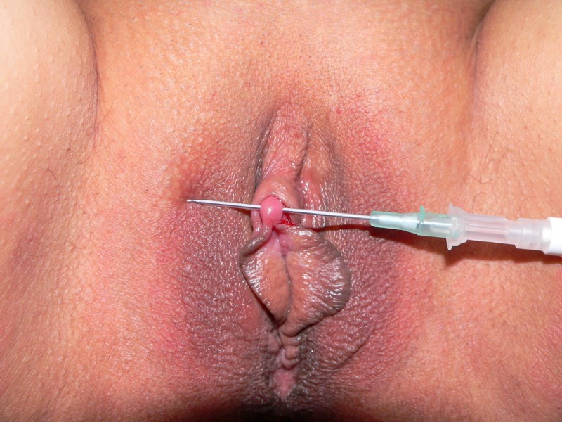 Extreme intimate piercing