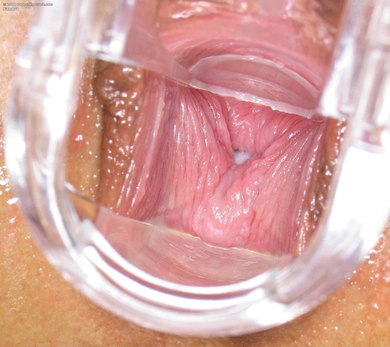 The camera inside the vagina