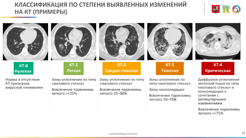Drain of correspondence