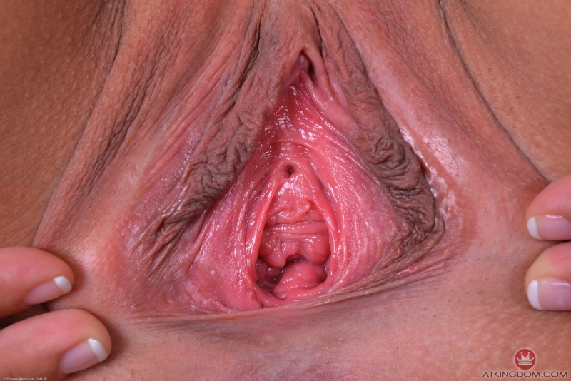 Widely opened vagina