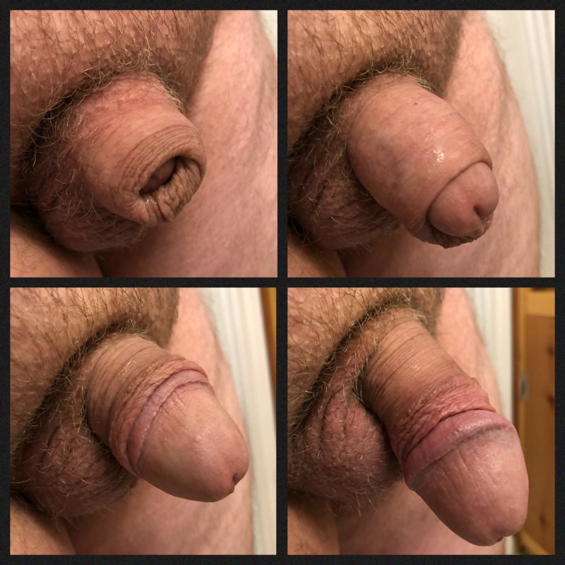 Shaved Circumcified Flaccid Penis at home