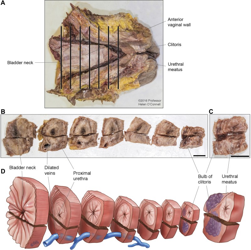 Vagina with testosterone