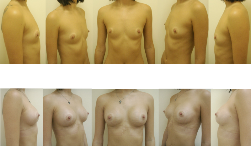 Women's boobs of different sizes