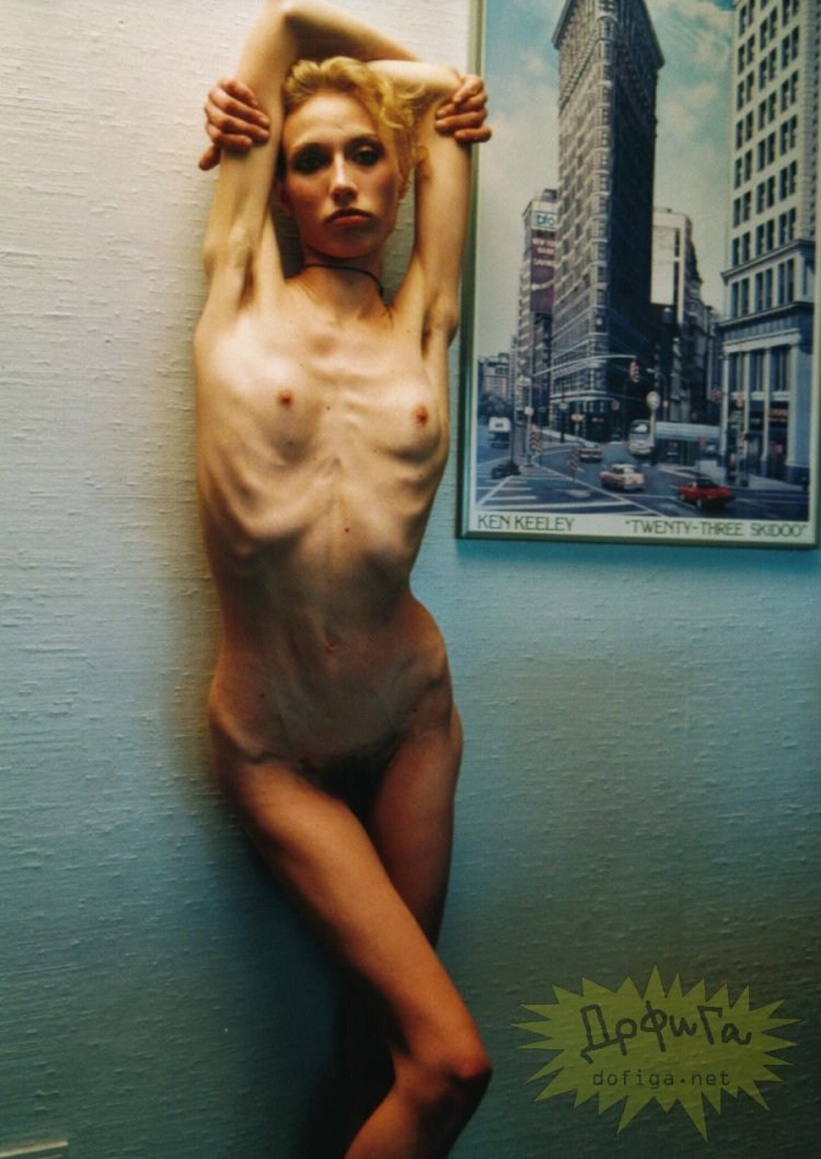 Naked carnival +anorexic