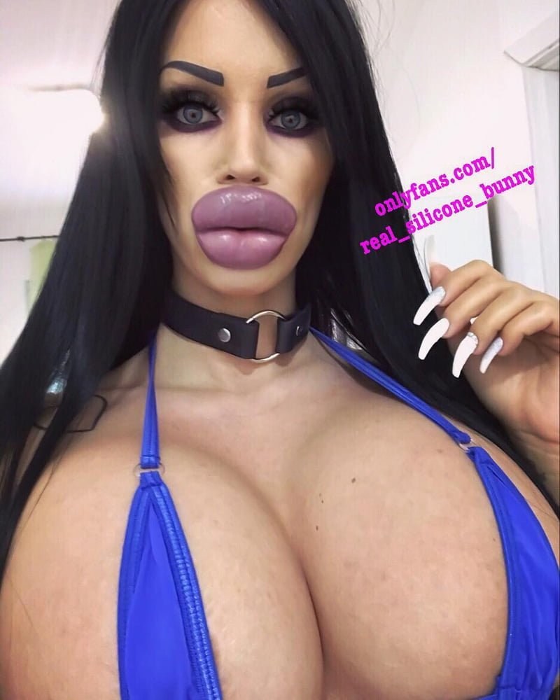 Huge silicone boobs and lips