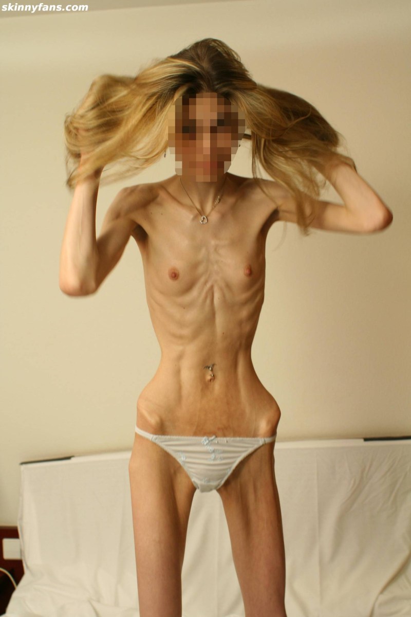 In stockings, thin naked anorexia