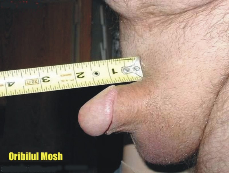 The smallest male dick