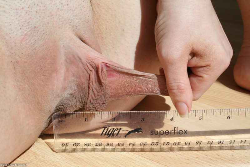Measurement of the depth of the vagina